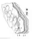 Fig. 16 - Methods for using self-retaining sutures in endoscopic procedures