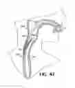Fig. 31 - Methods for using self-retaining sutures in endoscopic procedures