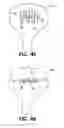 Fig. 33 - Methods for using self-retaining sutures in endoscopic procedures