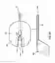 Fig. 06 - Magnaretractor system and method