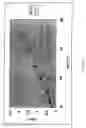 Fig. 02 - Methods and compositions to reduce scattering of light during therapeutic and diagnostic imaging procedures