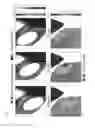 Fig. 07 - METHOD FOR CALCULATING PRESSURES IN A FLUID STREAM THROUGH A TUBE SECTION, ESPECIALLY A BLOOD VESSEL WITH ATHEROSCLEROTIC PLAQUE