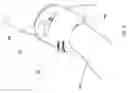 Fig. 09 - RECYCLABLE OR BIODEGRADABLE BLOOD PRESSURE CUFF