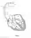 Fig. 07 - Method and system for heart failure status evaluation based on a disordered breathing index