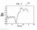 Fig. 07 - Duodenal eating sensor