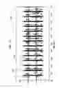 Fig. 10 - Duodenal eating sensor