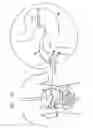 Fig. 14 - Duodenal eating sensor