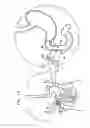 Fig. 15 - Duodenal eating sensor