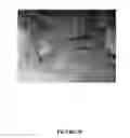 Fig. 25 - SYSTEM AND METHOD OF TREATING TISSUE WITH ULTRASOUND ENERGY