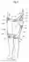 Fig. 02 - Walking assistance device