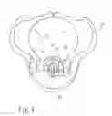 Fig. 02 -  MOBILIZING NECK SUPPORT DEVICE