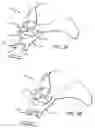 Fig. 04 - Cervical-thoracic orthotic with cervical collar
