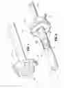 Fig. 02 - Access sheath with central seal