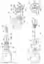 Fig. 02 - Manual intraosseous device