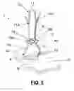 Fig. 04 - Fixation device for the fixation of bone fragments