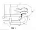 Fig. 02 - TRANS-SEPTAL PACING METHOD AND APPARATUS