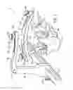 Fig. 02 - Fixation-based surgery