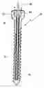 Fig. 01 - Bone screw
