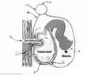 Fig. 01 - SYSTEM, METHOD AND APPARATUS FOR CONTROL OF ENTEROSTOMIES
