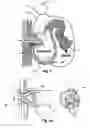 Fig. 03 - SYSTEM, METHOD AND APPARATUS FOR CONTROL OF ENTEROSTOMIES