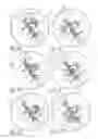 Fig. 05 - Various apparatus and methods for deep brain stimulating electrodes