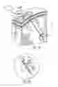 Fig. 07 - Various apparatus and methods for deep brain stimulating electrodes