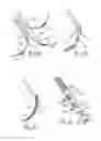 Fig. 14 - Various apparatus and methods for deep brain stimulating electrodes