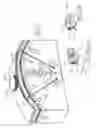Fig. 17 - Various apparatus and methods for deep brain stimulating electrodes