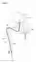 Fig. 02 - Device and method for treatment of tissue adjacent a bodily conduit by thermocompression