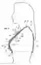 Fig. 08 - Therapeutic garment