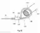 Fig. 09 - Pelvic implanted neural electrode and method for implanting same