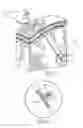 Fig. 08 - Various apparatus and methods for deep brain stimulating electrodes