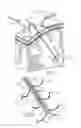 Fig. 13 - Various apparatus and methods for deep brain stimulating electrodes