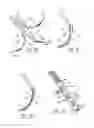 Fig. 14 - Various apparatus and methods for deep brain stimulating electrodes