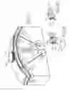 Fig. 17 - Various apparatus and methods for deep brain stimulating electrodes