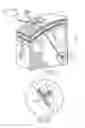 Fig. 08 - Various apparatus and methods for deep brain stimulating electrodes