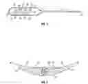 Fig. 02 - Winged electrode body for spinal cord stimulation
