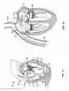 Fig. 02 - METHODS, SYSTEMS AND DEVICES FOR CARDIAC VALVE REPAIR