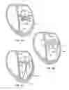 Fig. 22 - METHODS, SYSTEMS AND DEVICES FOR CARDIAC VALVE REPAIR