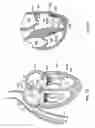 Fig. 32 - METHODS, SYSTEMS AND DEVICES FOR CARDIAC VALVE REPAIR