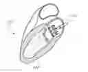 Application 20100298931, fig. 01