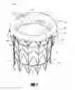 Fig. 02 - Vascular implant and delivery system