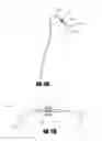 Fig. 09 - Vascular implant and delivery system