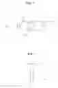 Fig. 04 - Tensile force-adjustable fixing tool for fixing tendon graft and ligament reconstruction method