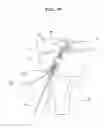 Fig. 28 - Tensile force-adjustable fixing tool for fixing tendon graft and ligament reconstruction method