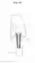 Fig. 32 - Tensile force-adjustable fixing tool for fixing tendon graft and ligament reconstruction method