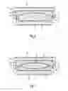 Fig. 03 - Intervertebral Disc Implant