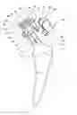 Fig. 01 - Orthopaedic joint prosthesis implant kit