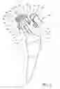 Fig. 02 - Orthopaedic joint prosthesis implant kit