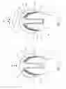 Fig. 02 - Method of implanting an implant including bone abrasion